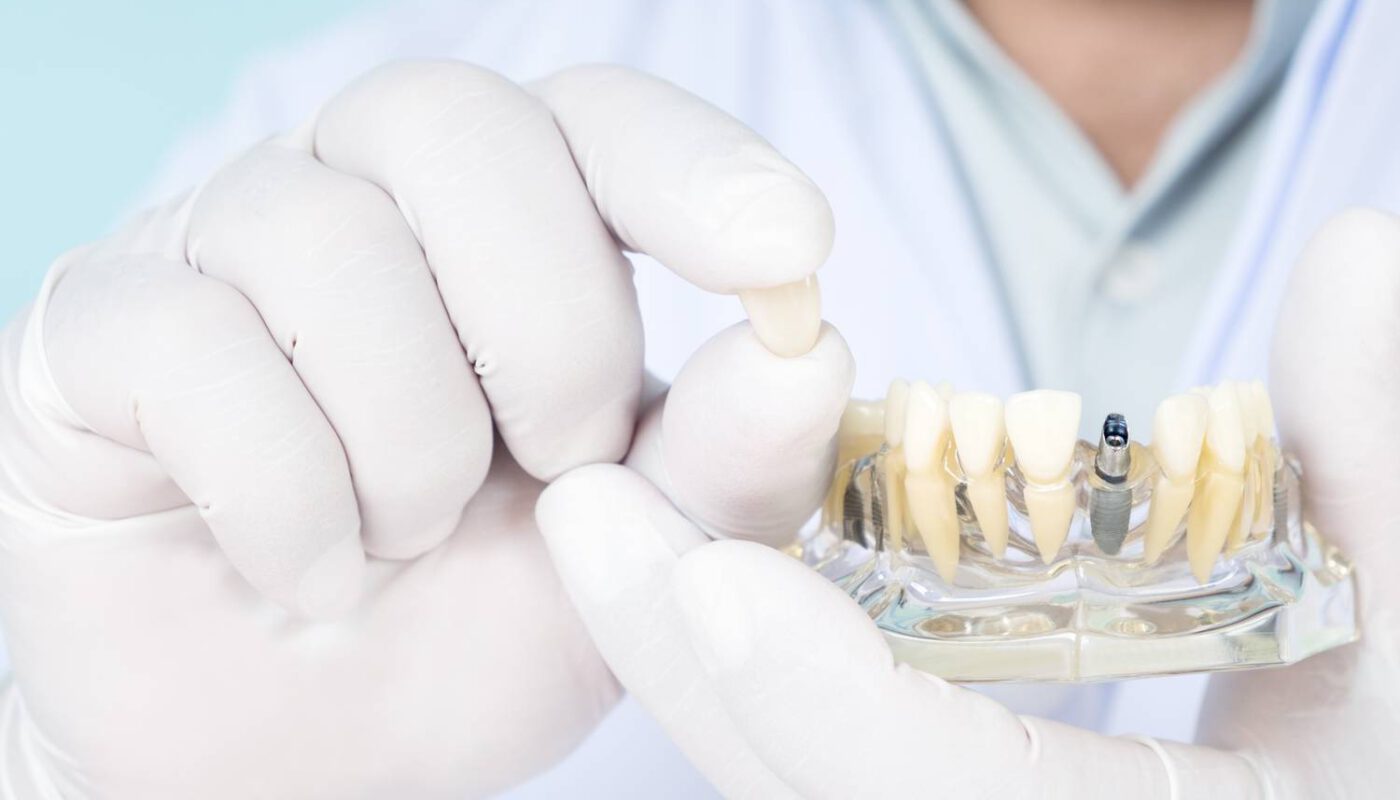 Przeciwwskazania do implantów stomatologicznych
