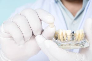 Przeciwwskazania do implantów stomatologicznych