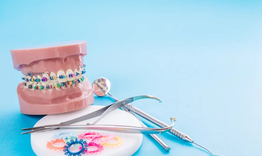 Co trzeba wiedzieć o implantach zębowych?