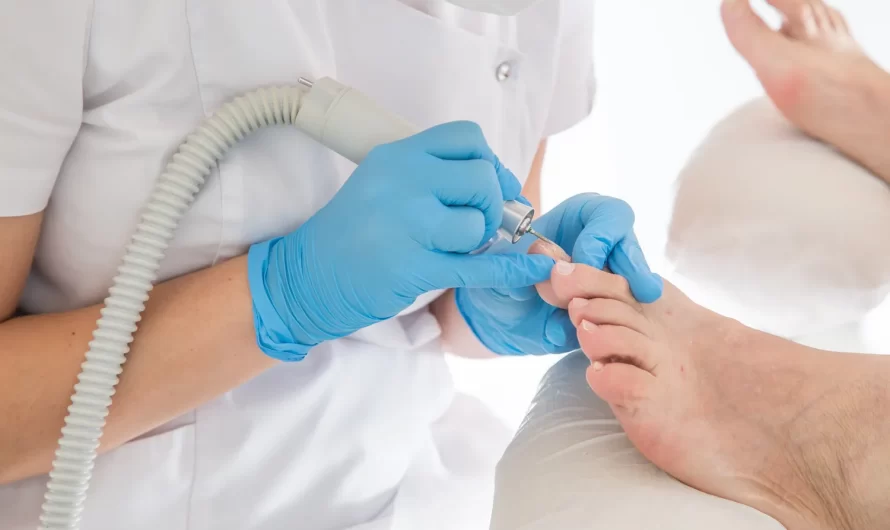 Pedicure leczniczy – co na ten temat wiedzieć trzeba?