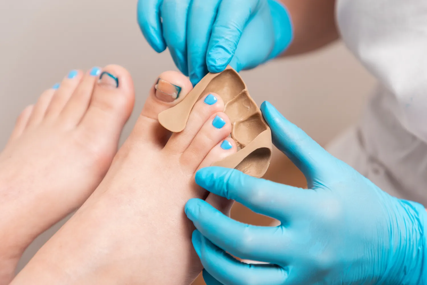 Pedicure leczniczy - co na ten temat wiedzieć trzeba?
