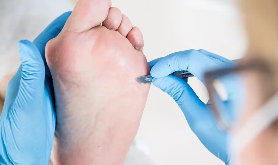 Pedicure leczniczy