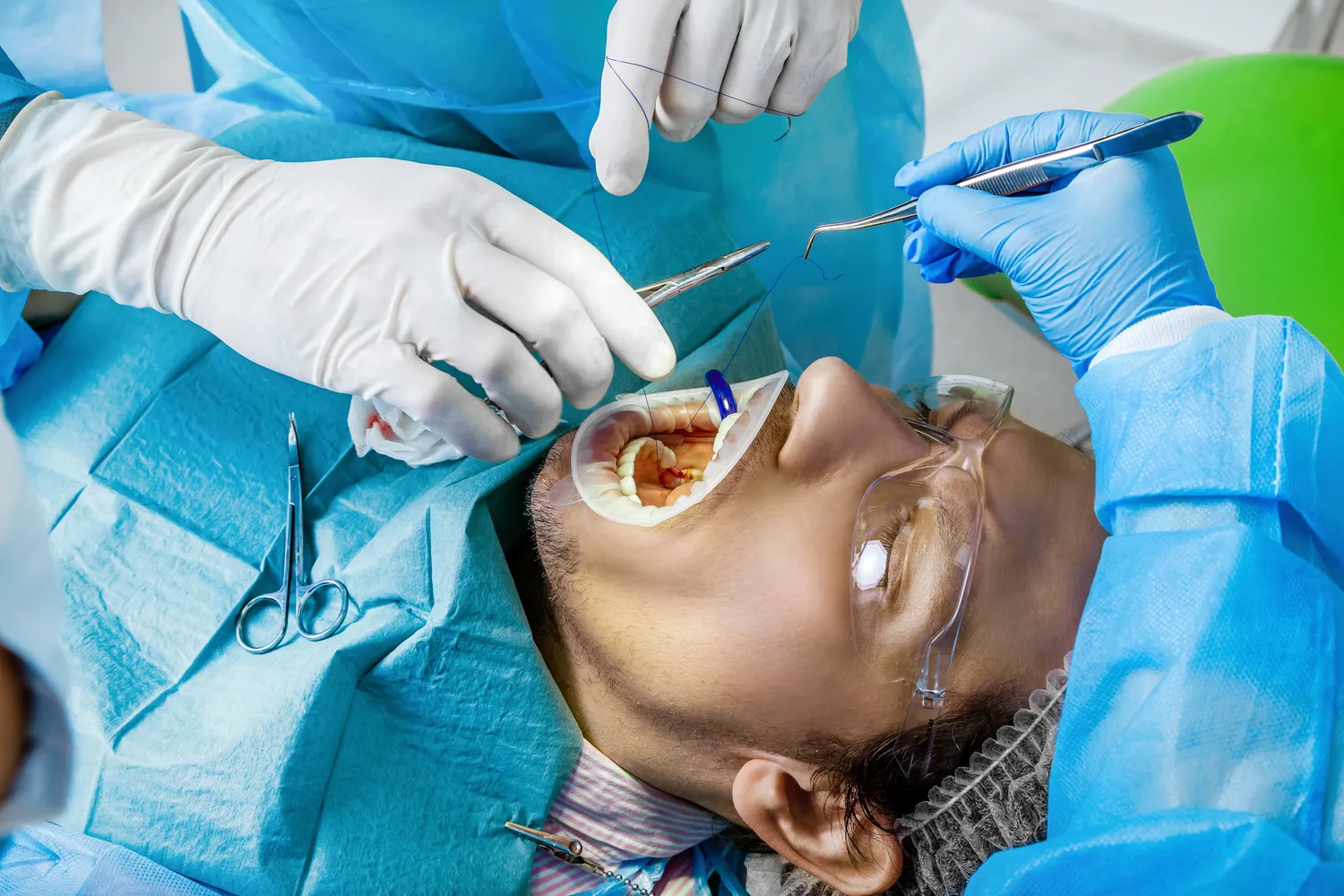 E recepta o co chodzi?