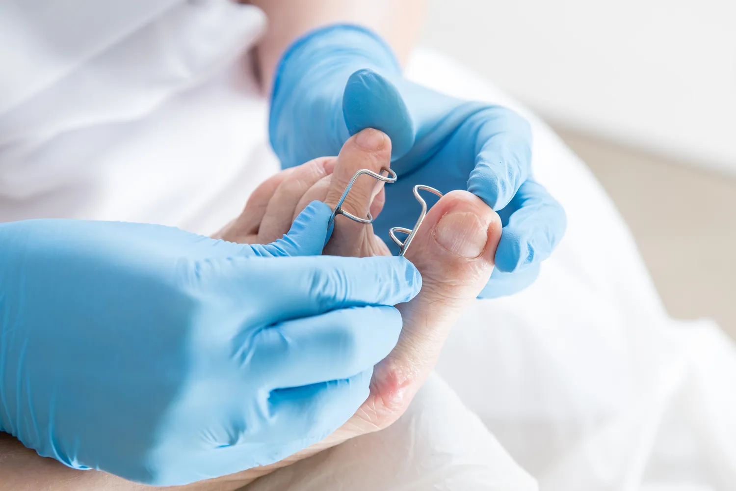 Podologia – zdrowe stopy